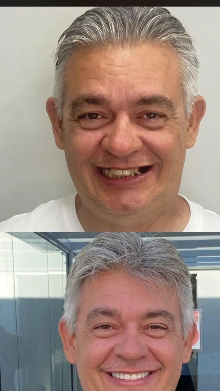 Registro de caso clínico 14 — Dr. Lucas Cosmam