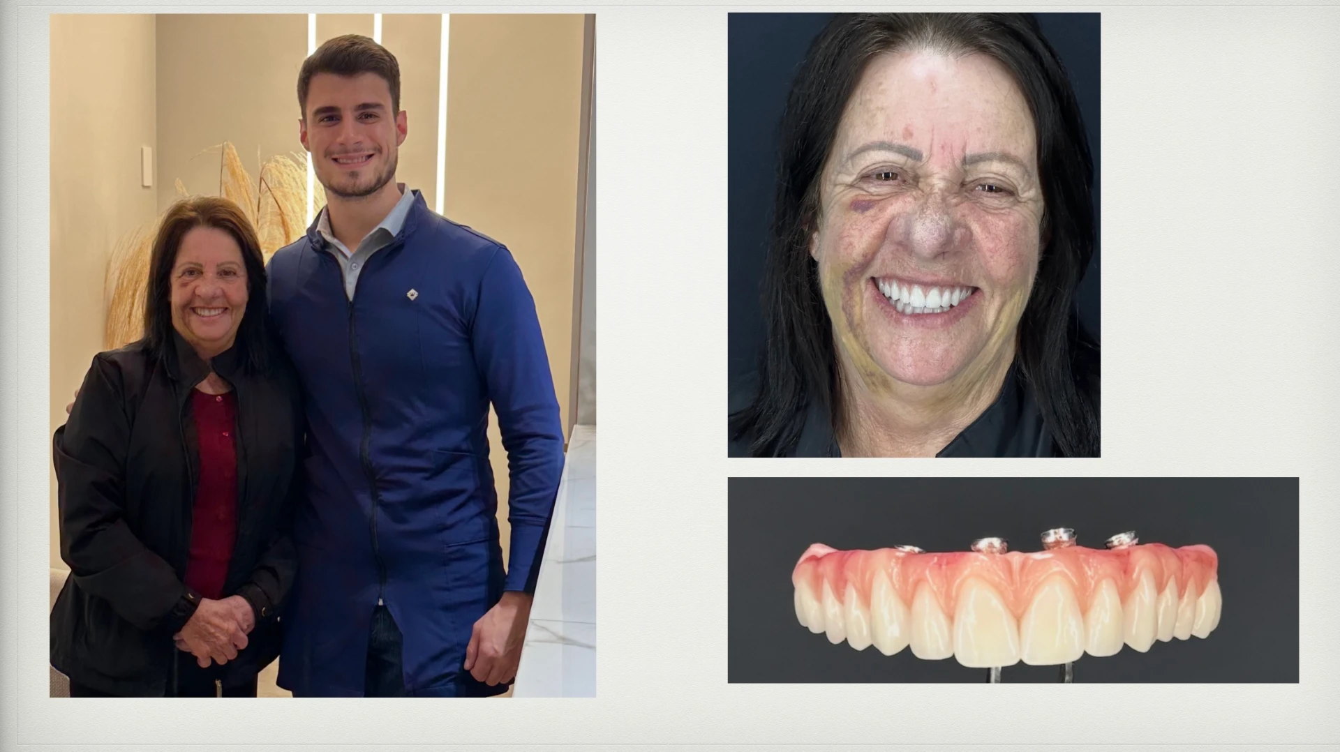 Registro de caso clínico 7 — Dr. Lucas Cosmam