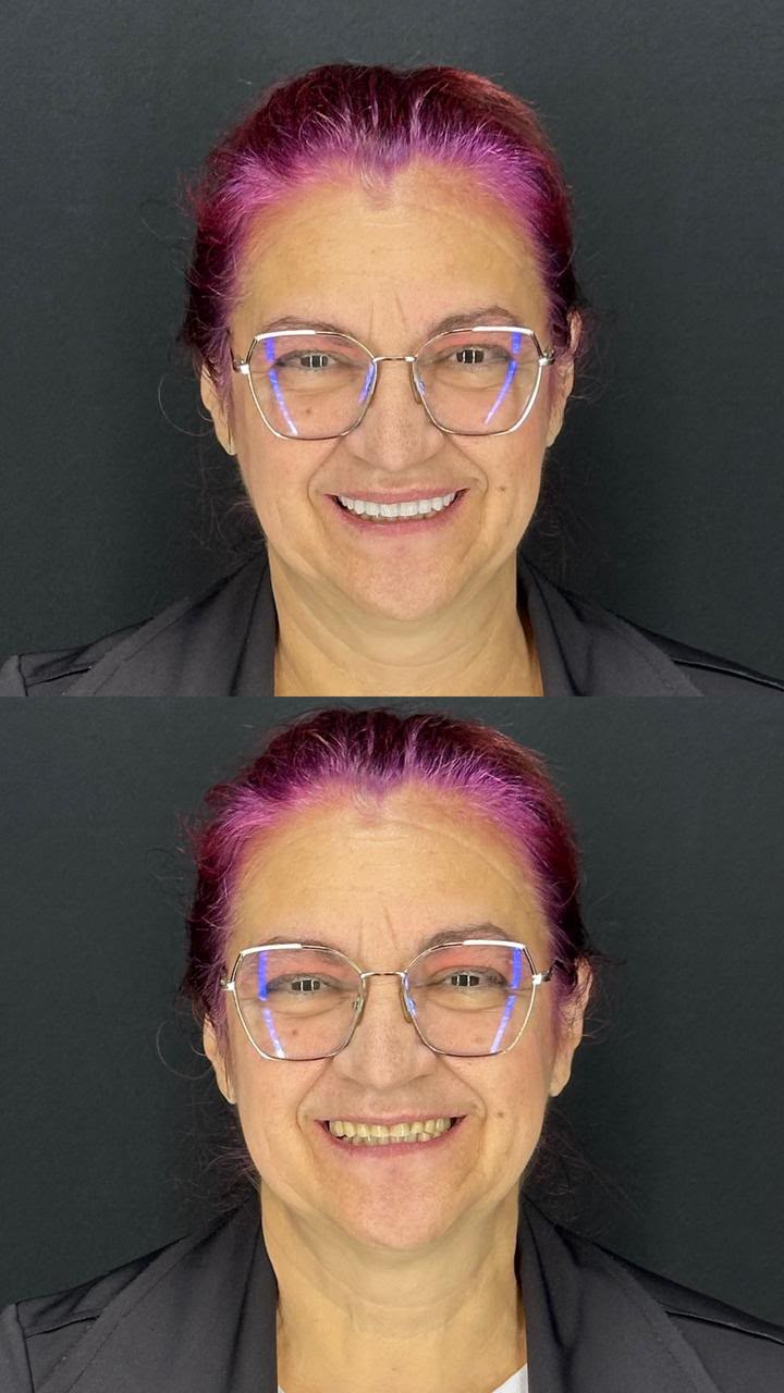 Registro de caso clínico 11 — Dr. Lucas Cosmam