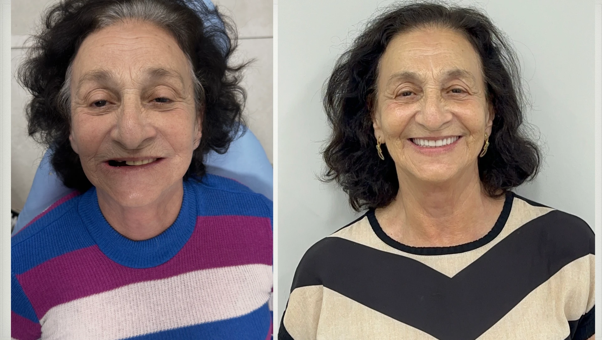 Registro de caso clínico 3 — Dr. Lucas Cosmam